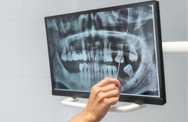 Digital_dental_radiology-service