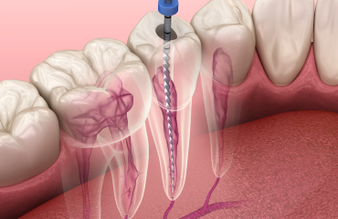 Endodontics-service