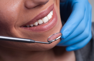 General_dentistry-service