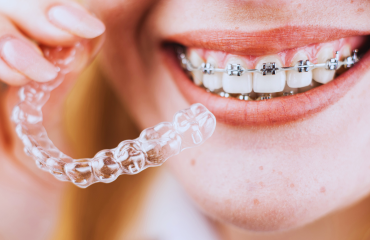 Orthodontics-service