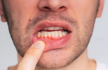 Periodontology-service