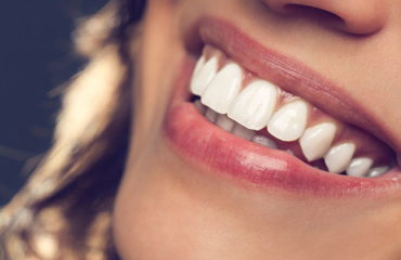 hollywood-smile-in-marrakech-hero-section